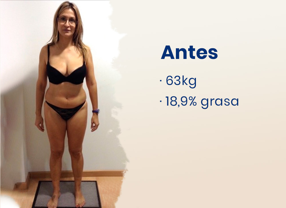 Antes