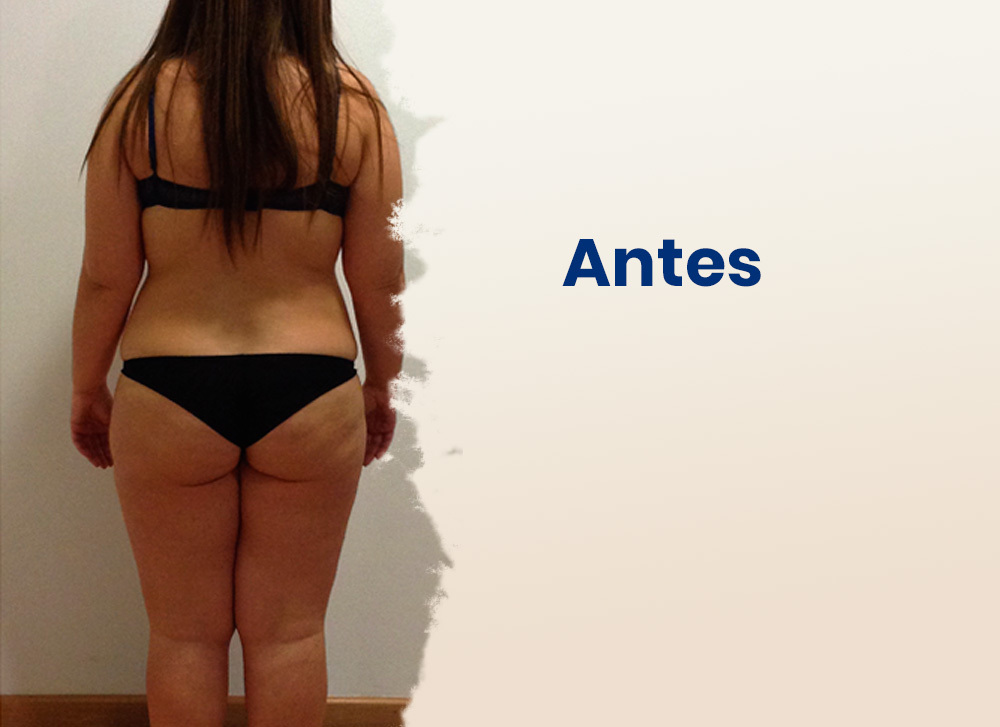 Antes