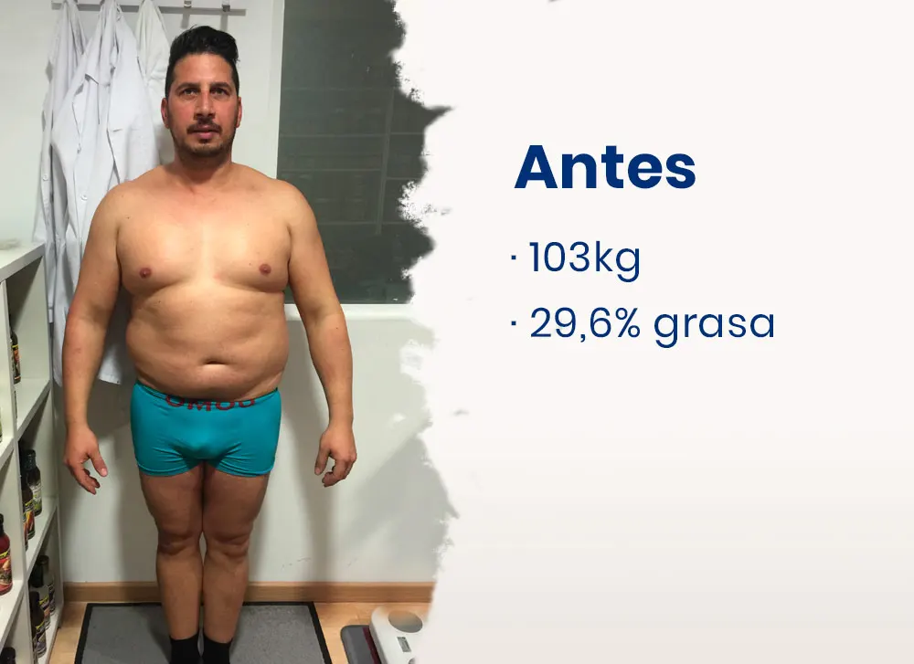Antes